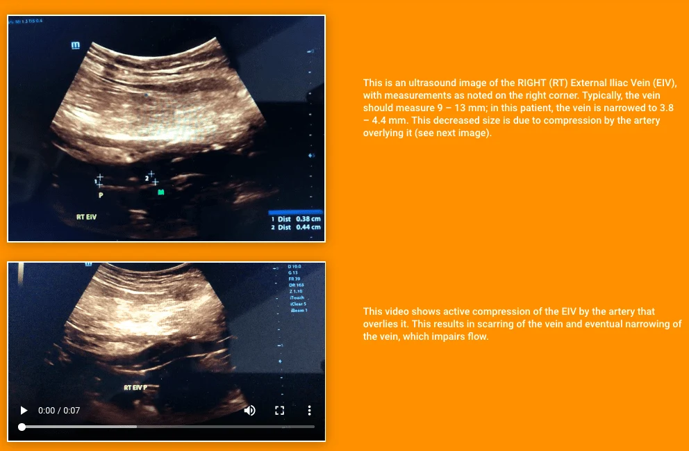 Ultrasound Image