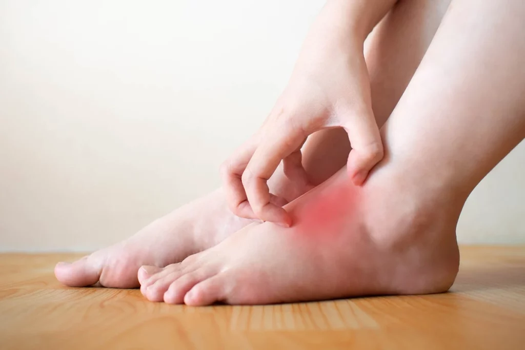 Lower Extremity Swelling, a symptom of conditions such as May-Thurner Syndrome