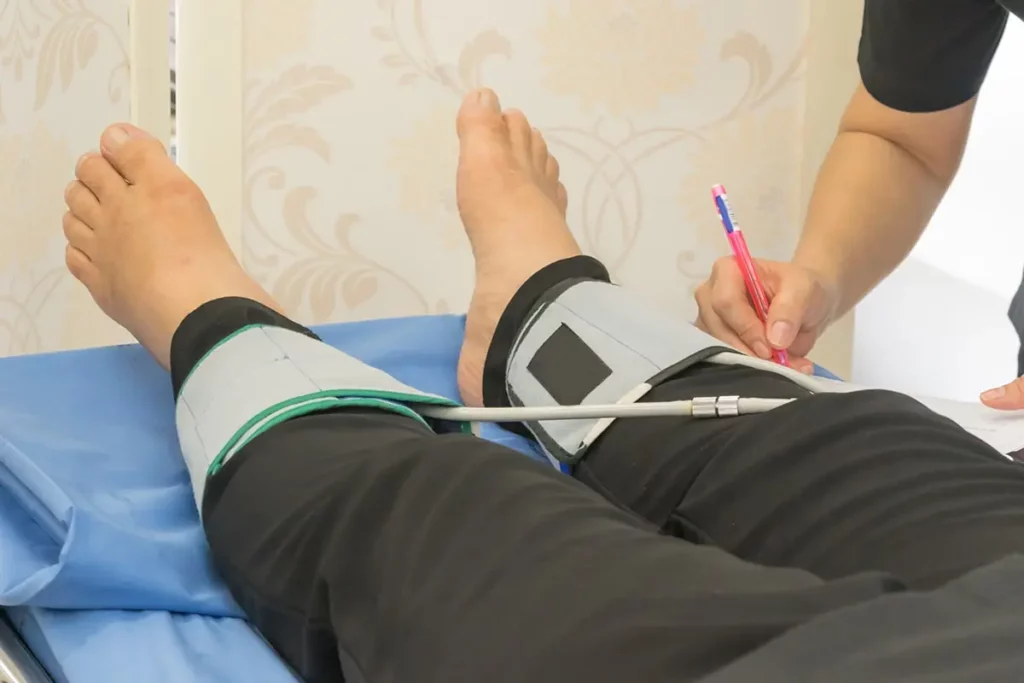 Peripheral Artery Disease Treatment